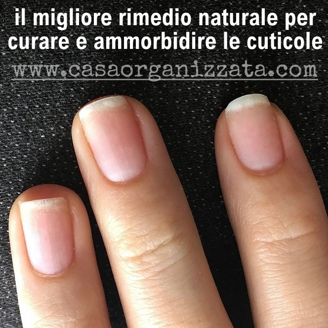 il migliore rimedio naturale per curare e ammorbidire le cuticole